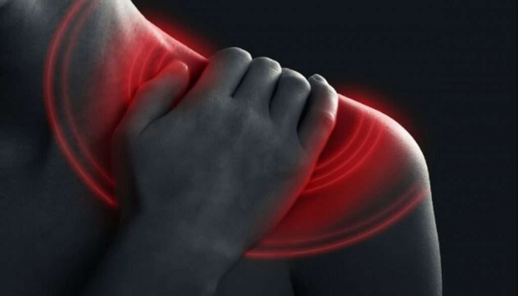 شانه یخ زده (Frozen shoulder)