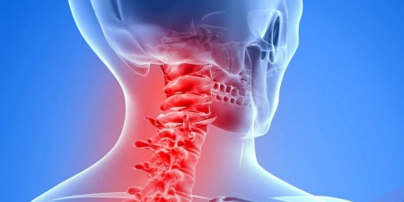 تاثیرات تغذیه بر آرتروز گردن