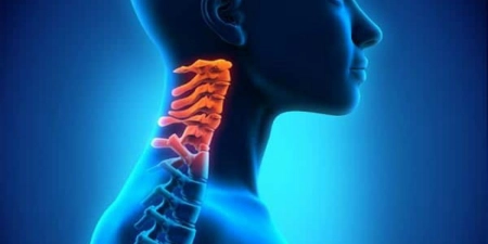 عوامل خطر اسپوندیلوز چیست؟