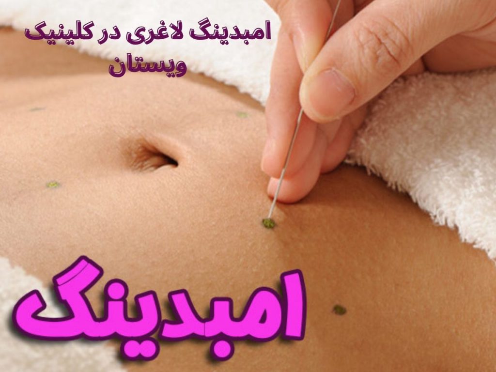 انواع امبدینگ لاغری
