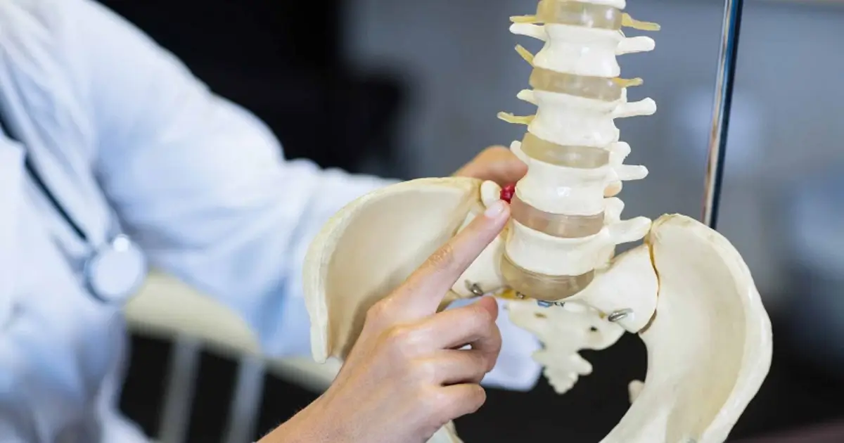 علائم دیسک کمر چیست (معرفی 20 علامت شایع دیسک کمر)