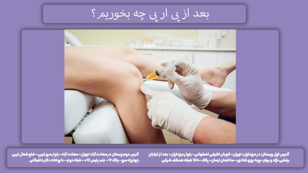 تغذیه بعد پی ار پی بعد از پی ار پی چه بخوریم؟