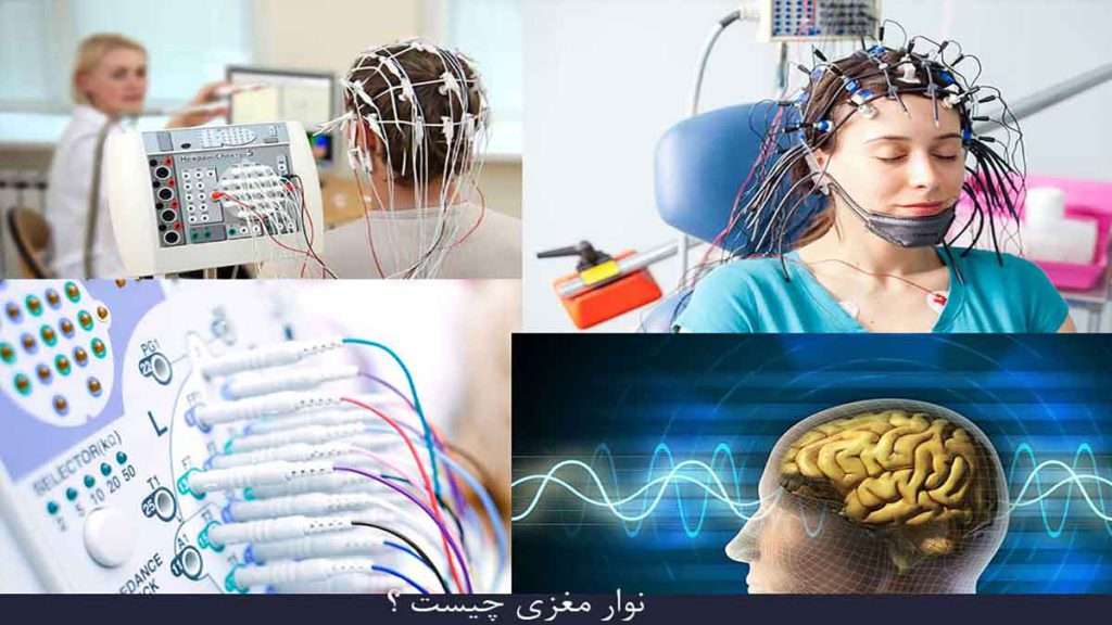 نوار عصب چشم