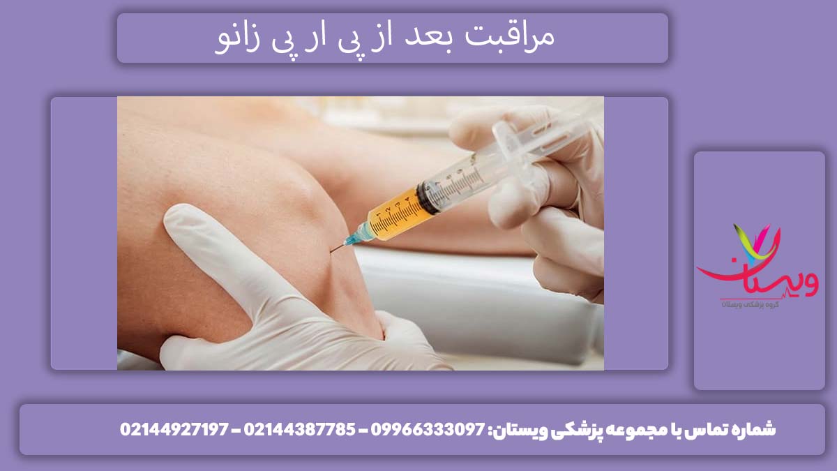مراقبت های بعد از پی آر پی زانو چیست؟