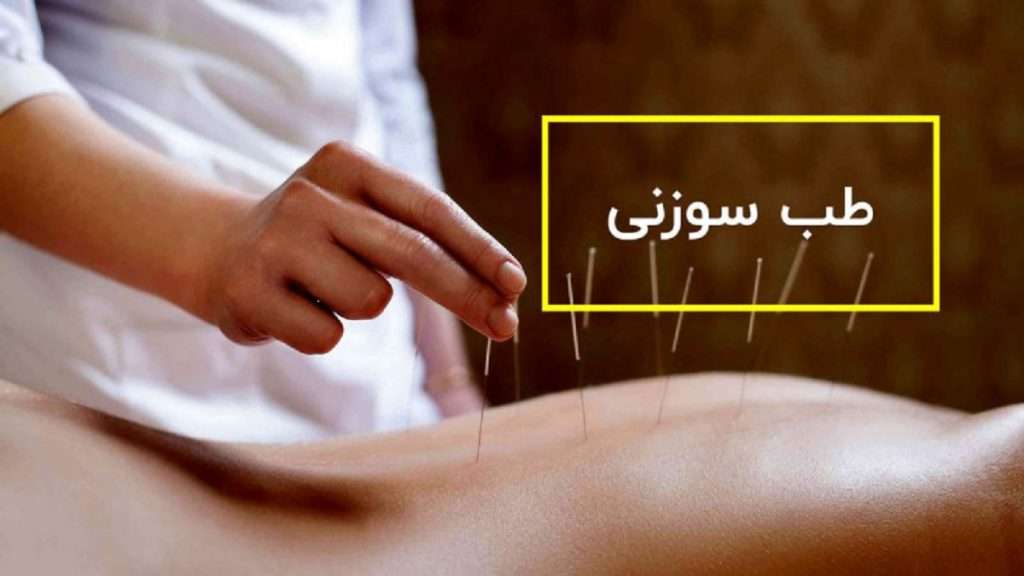 طب سوزنی