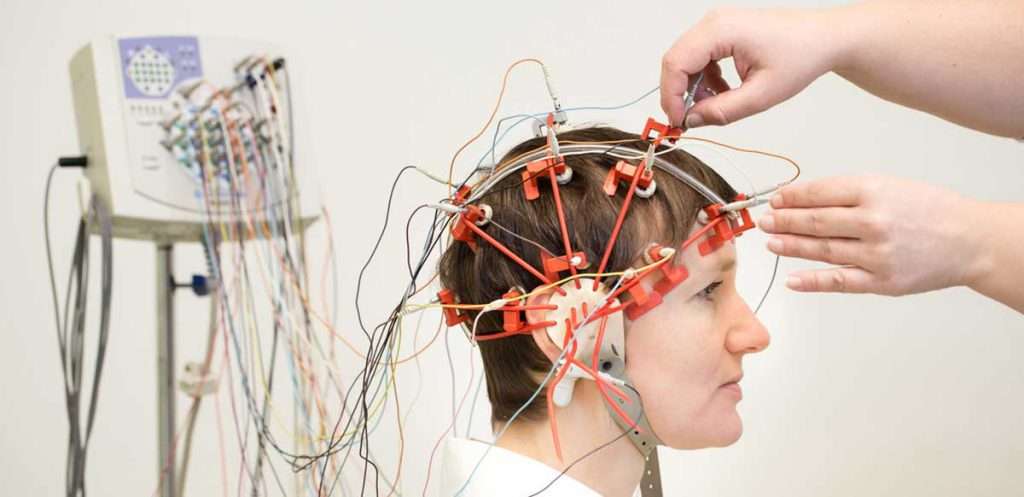 بیمار در حال درمان با دستگاه الکتروانسفالوگرام (EEG)