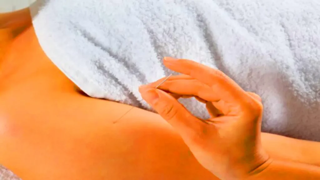 برخی افراد گزارش کردهاند که سوزنگذاری میتواند به بهبود کیفیت خواب کمک کند. طب سوزنی