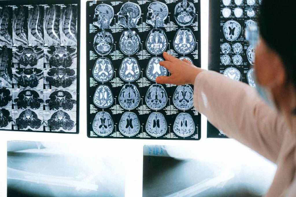 تصویر پزشک در حال مشاهده عکس مغز