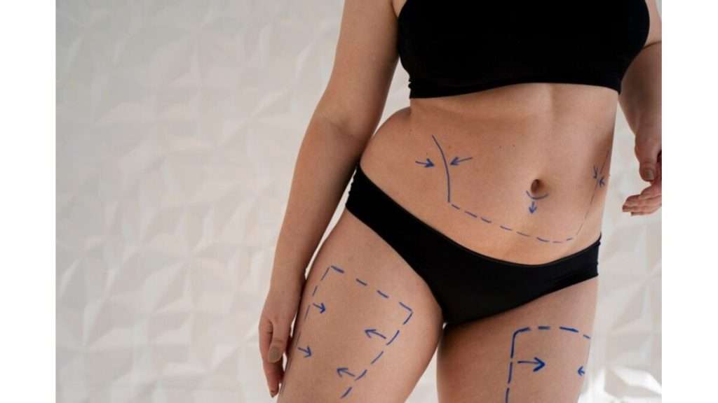 عوارض امبدینگ شکم و ران فرد برای انجام عمل امبدینگ مشخص شده است