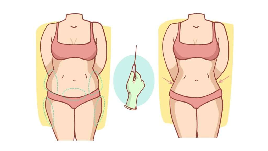 نقاط چربیسوزی مزایای امبدینگ لاغری