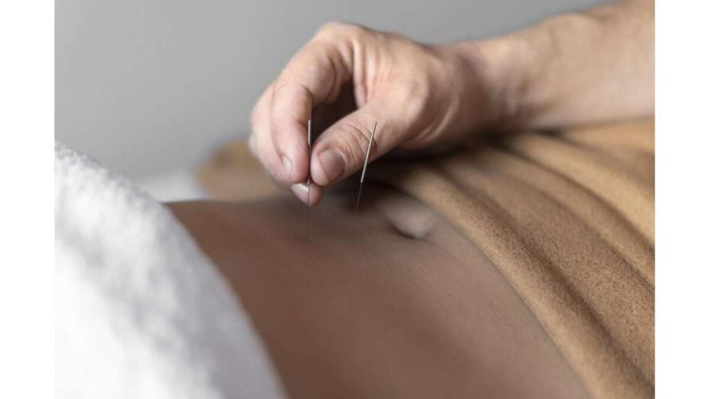 روش درمانی تدریجی دکتر طب سوزنی