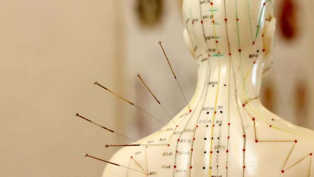 نقاط طب سوزنی روی آناتومی بدن انسان نقاط طب سوزنی روی آناتومی بدن انسان