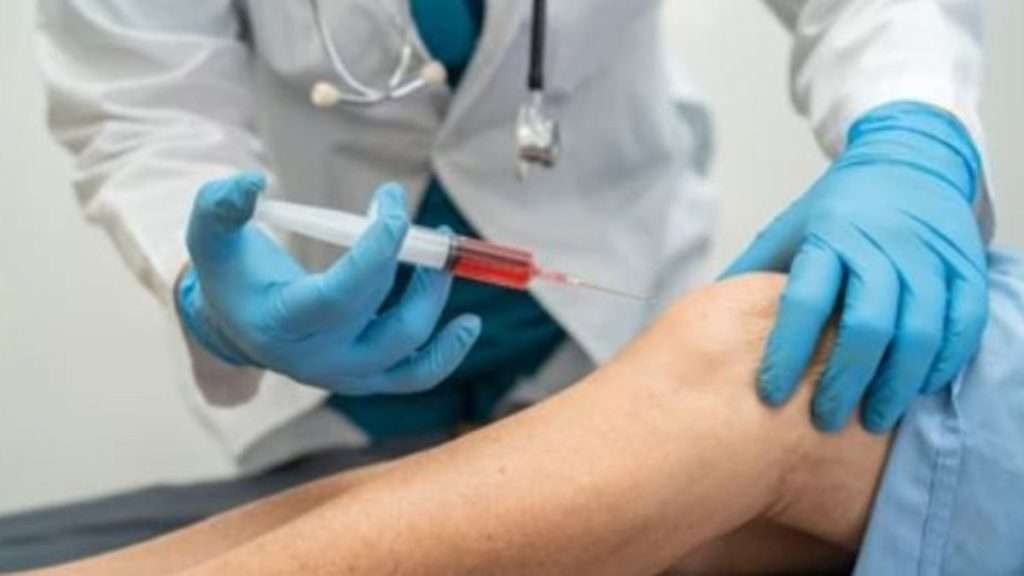 تزریق PRP به مفصل زانو یک ورزشکار توسط یک دکتر یک پزشک در حال تزریق PRP به مفصل زانو یک ورزشکار می باشد که می تواند به تسریع روند بهبودی ورزشکار کمک کند.