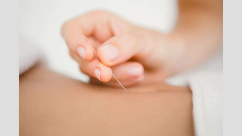 اثرات طب سوزنی اثرات طب سوزنی