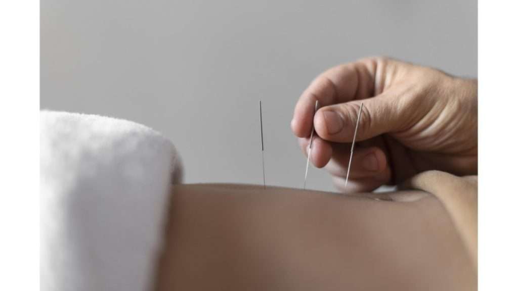 کاهش وزن با اکوپانچر