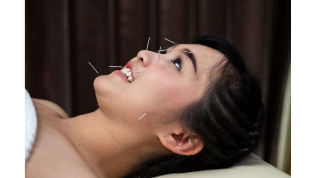 چین و چروک طب سوزنی