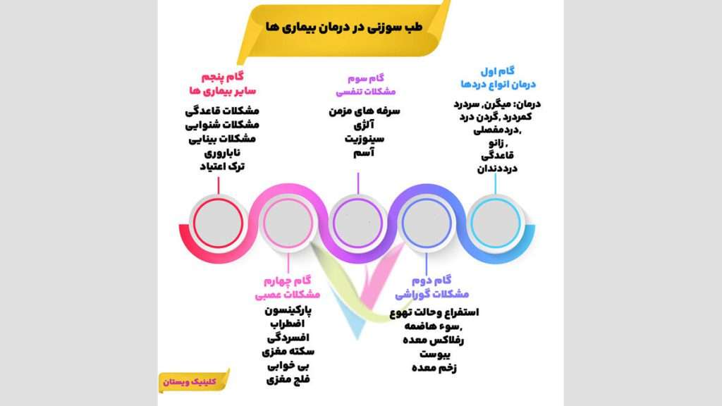 طب سوزنی در درمان بیماری طب سوزنی چه بیماریهایی را درمان میکند؟