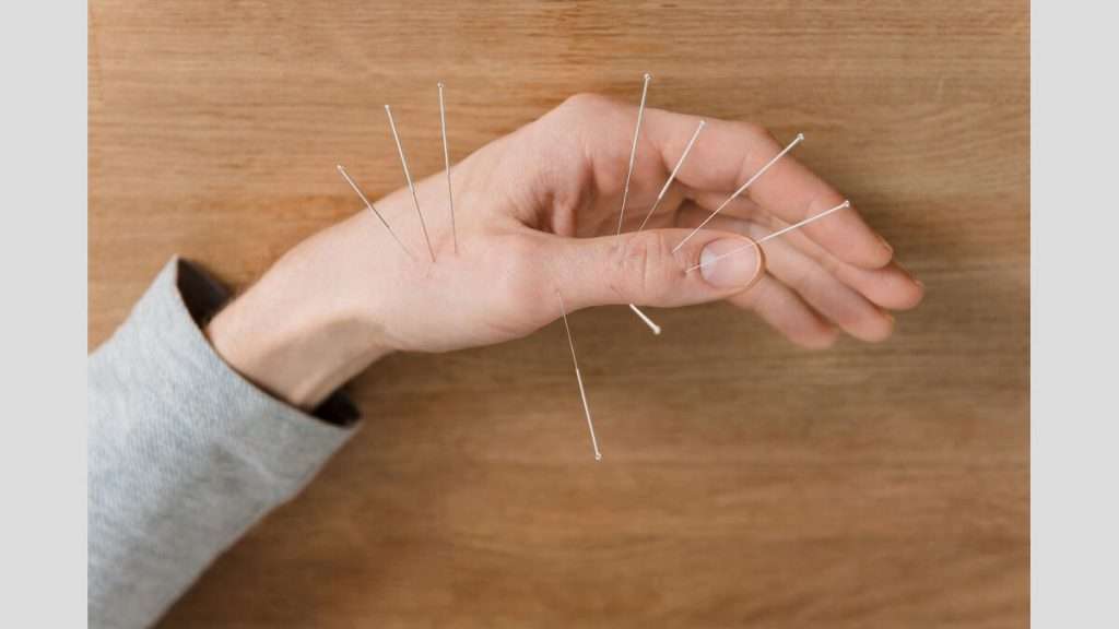 ارتروز طب سوزنی در درمان بیماری های اسکلتی و مفصلی