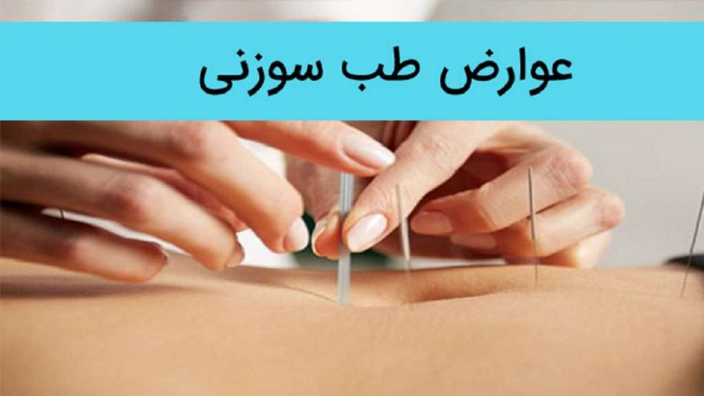 عوارض طب سوزنی عوارض طب سوزنی