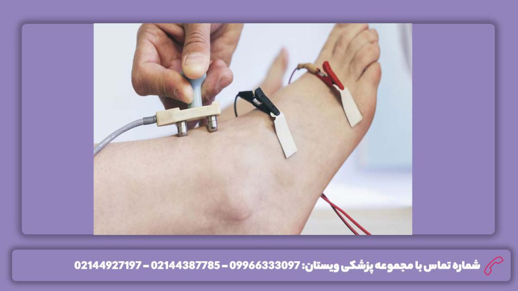 نکات قبل تست emg اقدامات قبل از انجام نوار عصب و عضله پا