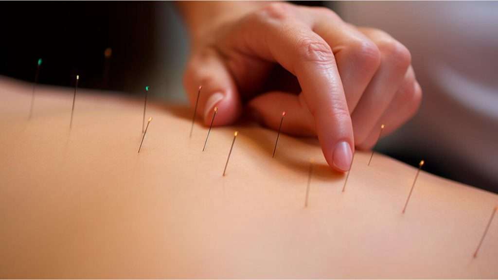 متخصص طب سوزنی ابزارهای طب سوزنی