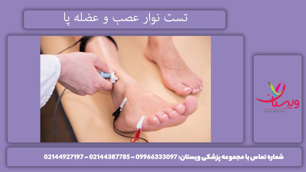 نوار عصب و عضله پا