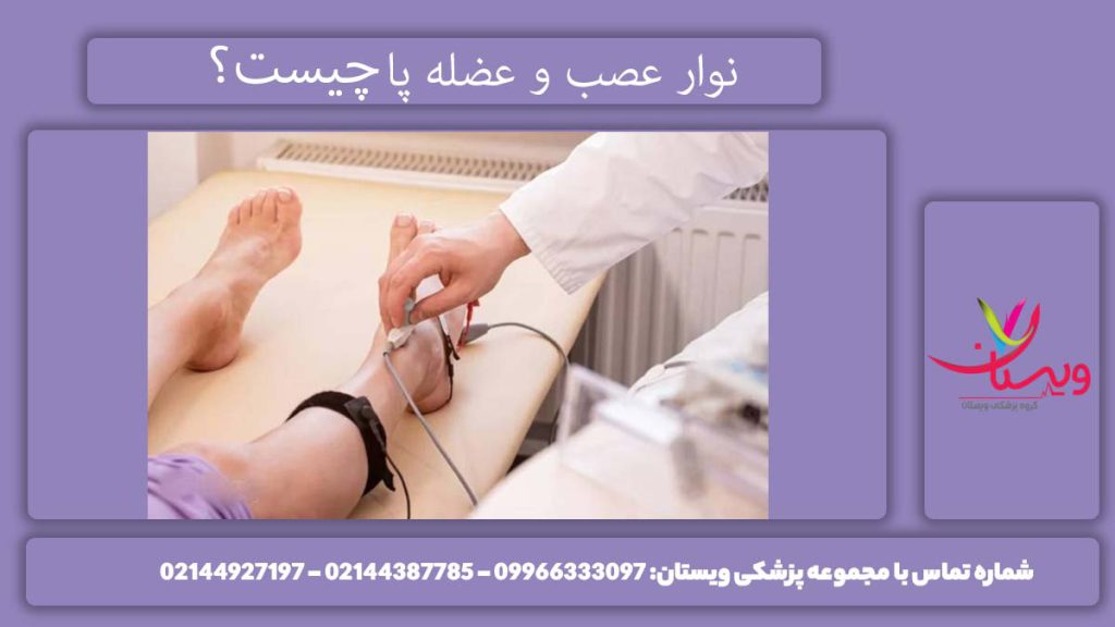 تست عصب پا نوار عصب و عضله پا چیست؟