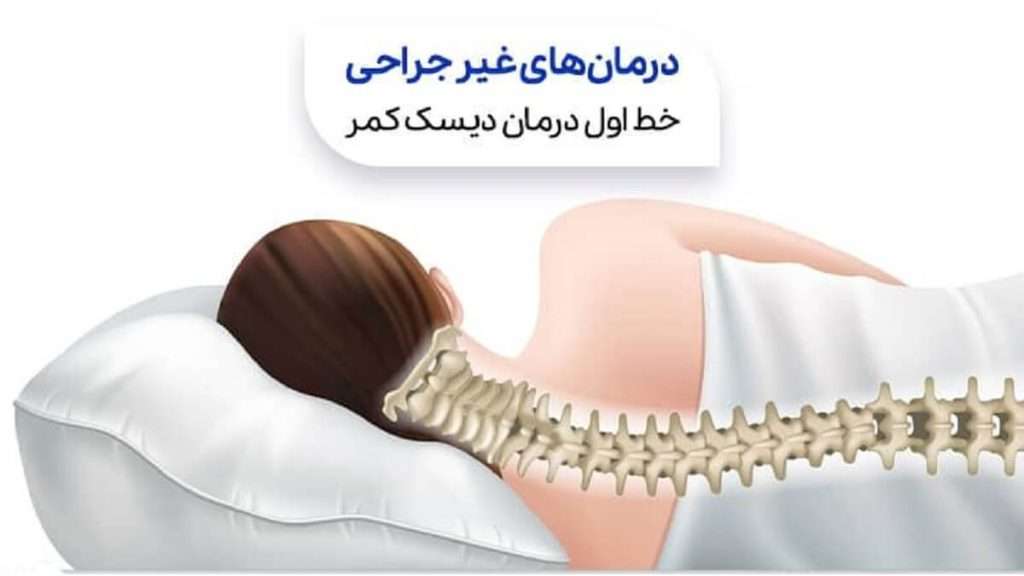 درمان غیرجراحی دیسک کمر