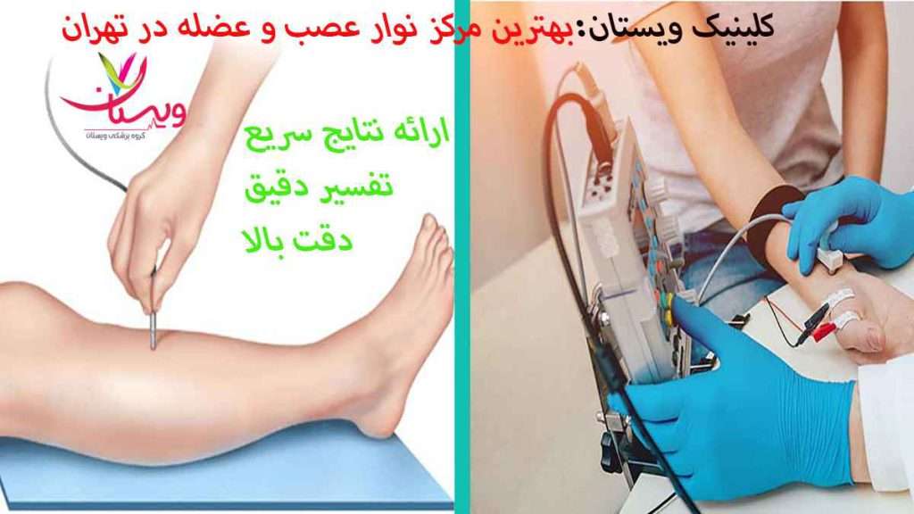 مرکز نوار عصب و عضله