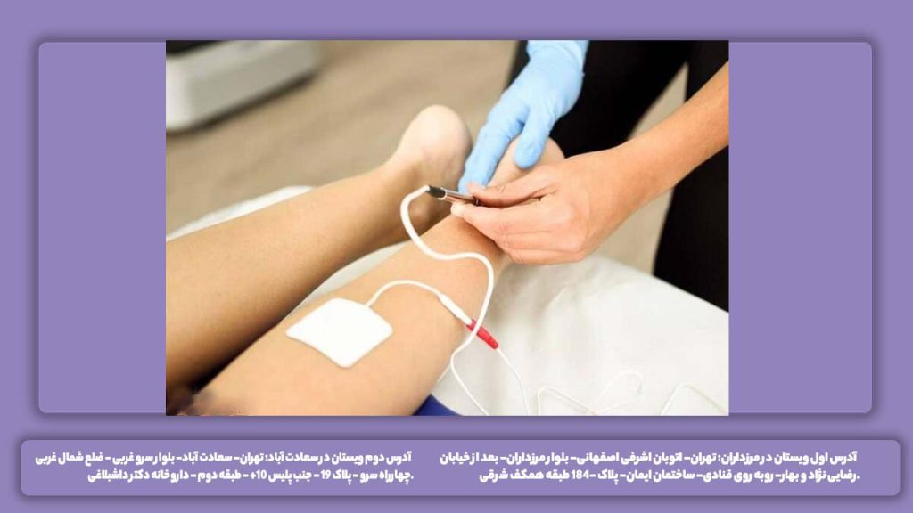 نرخ انجام تست عصب هزینه ارزیابی عصب و عضله پا
