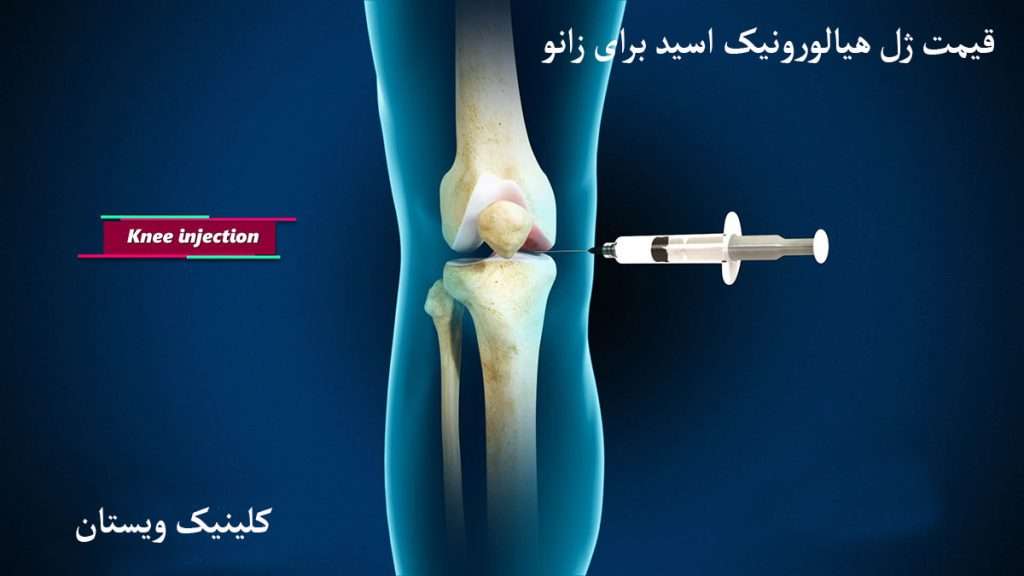 قیمت ژل زانو تزریق ژل به زانو