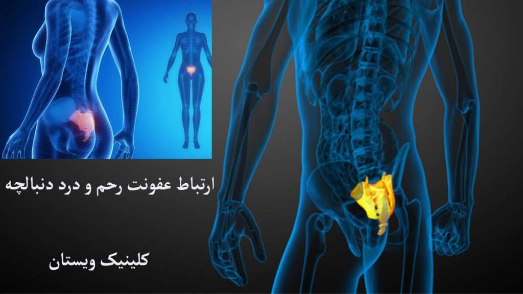 ارتباط بین عفونت رحم و درد دنبالچه عفونت رحم و دنبالچه نمایش داده می شود