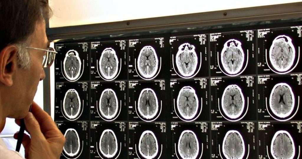 سطح بالای کلسترول خون میتواند به ایجاد لختههای خونی و سکته مغزی منجر شود. سکته مغزی میتواند منجر به ناتوانیهای دائمی شود.