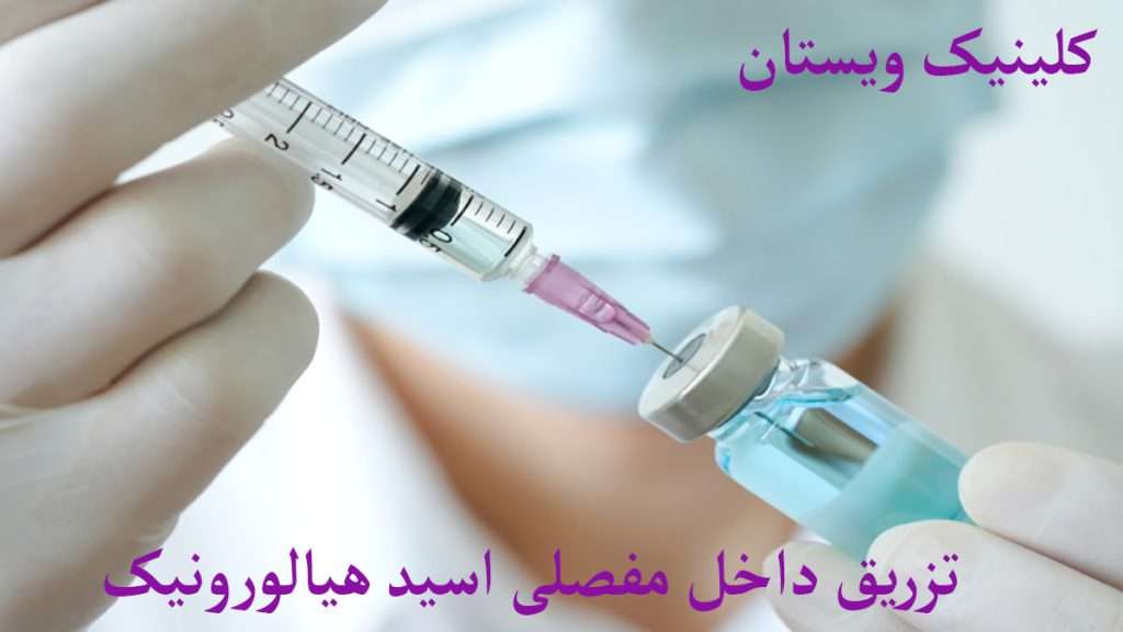 تزریق داخل مفصلی قیمت ژل هیالورونیک اسید برای زانو در داروخانه