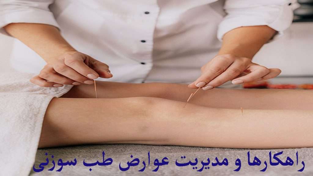 طب سوزنی طب سوزین زانو و مدیریت عوارض طب سوزنی