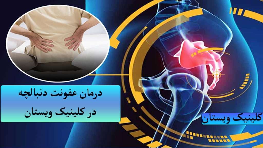 عفونت دنبالچه فردی دارای درد در ناحیه کمر و دنبالچه است
