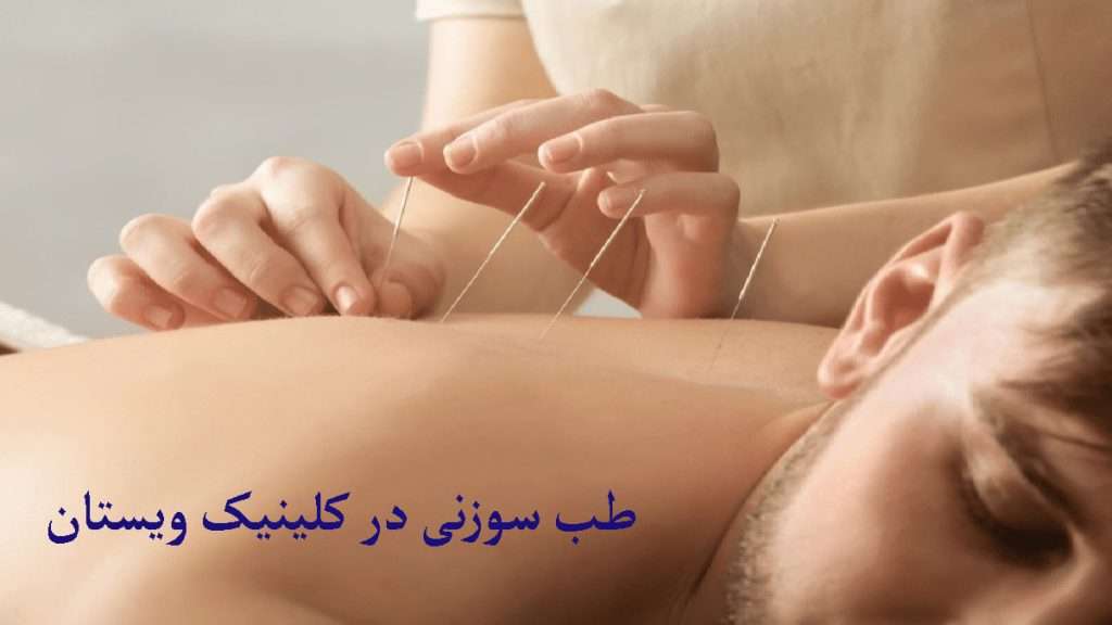 عوارض طب سوزنی متخصص طب سوزنی در حال درمان فرد با طب سوزنی می باشد