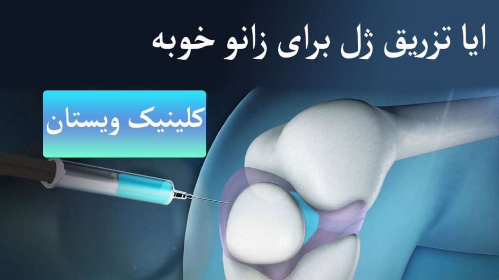 تزریق آمپول به داخل مفصل زانو تزریق آمپول به داخل مفصل زانو