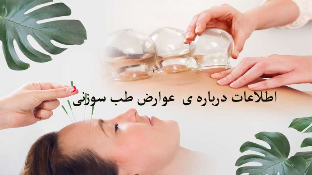 طب سوزنی صورت طب سوزنی برای صورت