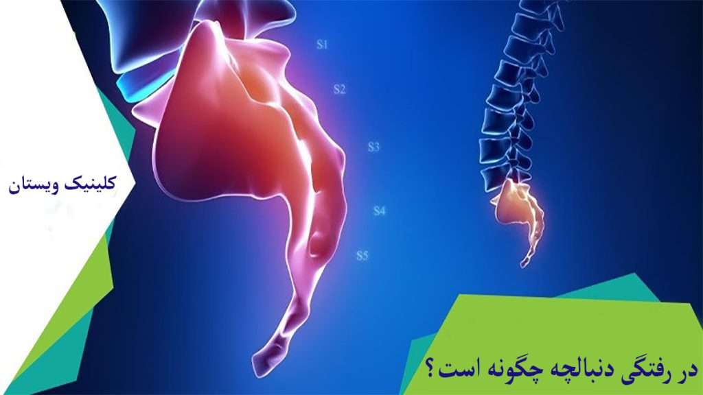 در رفتگی دنبالچه دنبالچه و ستون فقرا نشان داده می شود