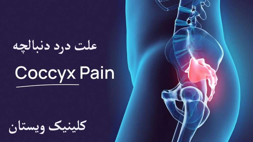 درد دنبالچه درد در ناحیه دنبالچه