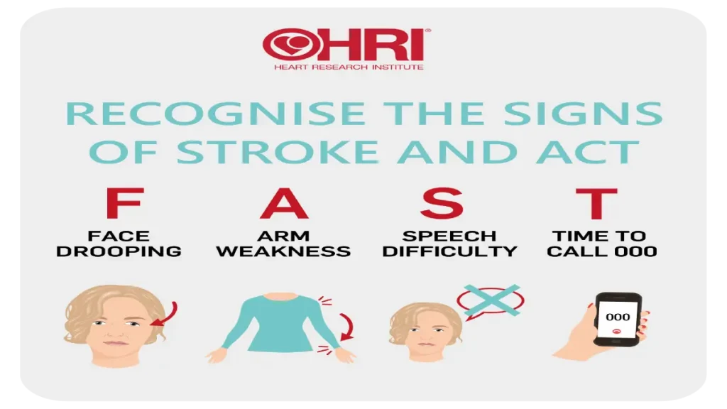افزایش آگاهی عمومی درباره علائم سکته مغزی میتواند به نجات جان افراد بیشتری کمک کند. داروی ترومبولیتیک میتواند به حل کردن لختههای خونی در سکته ایسکمیک کمک کند.