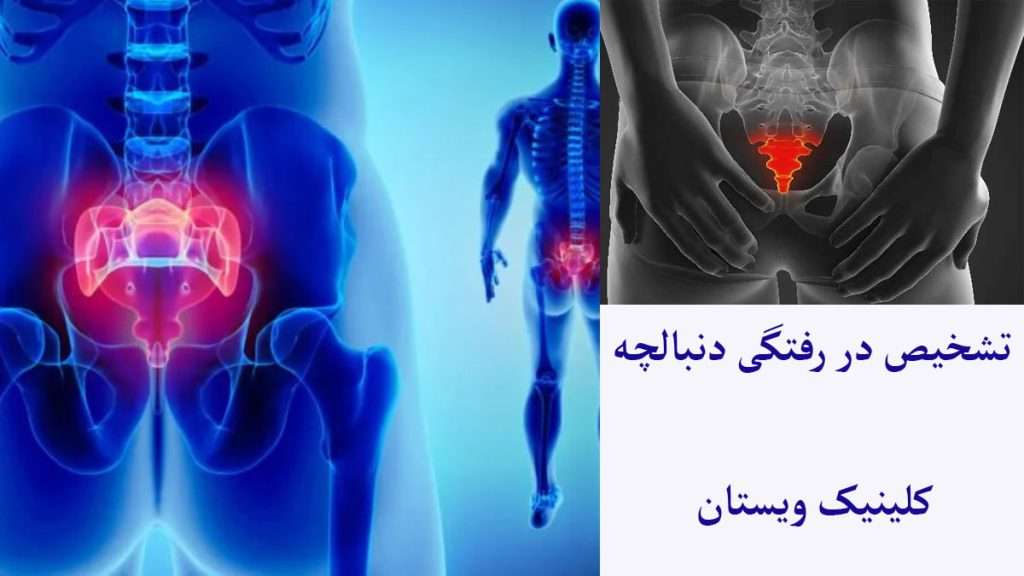 تشخیص مشکلات دنبالچه درد در ناحیه دنبالچه فرد نشان داده می شود