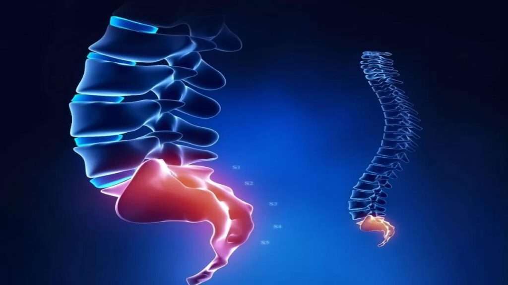 جراحی تخریبی مینیمالی جراحی برای درمان درد دنبالچه