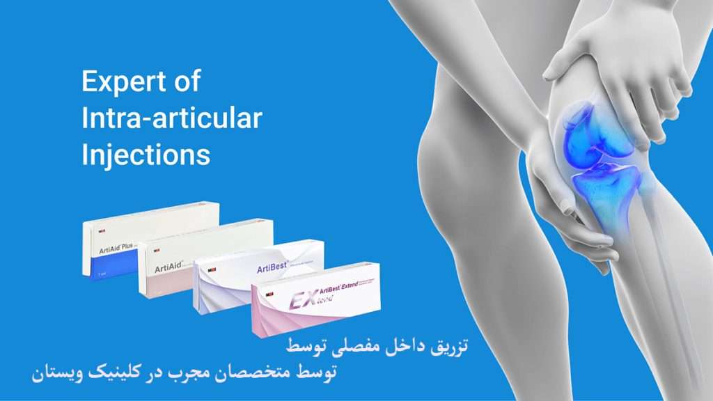 تزریق داخل مفصلی انواع آمپول برای تزریق به زانو