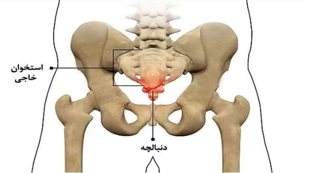 فشار بر عصبها اسپینال کورد