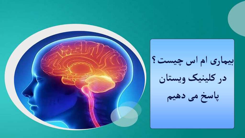 مغز بیمار دارای بیماری ام اس