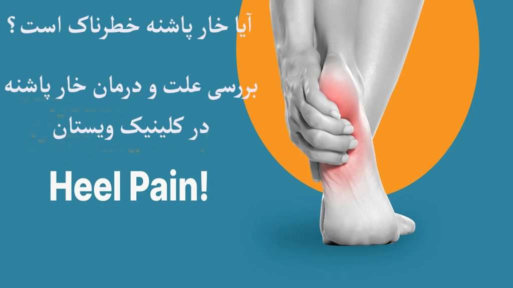 درد در ناحیه پاشنه پا به خاطر خار پاشنه