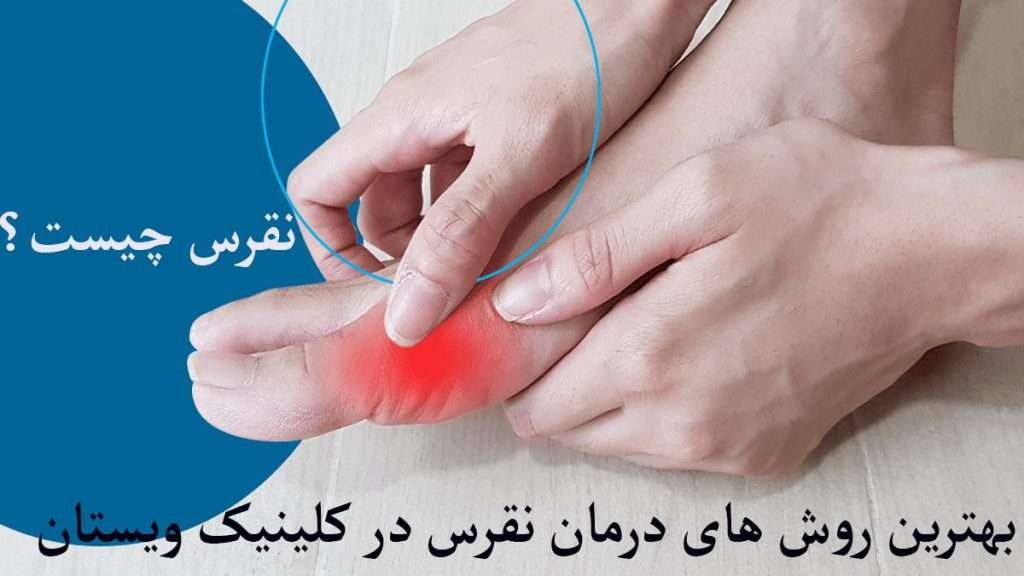شخصی دارای نقرس پا است