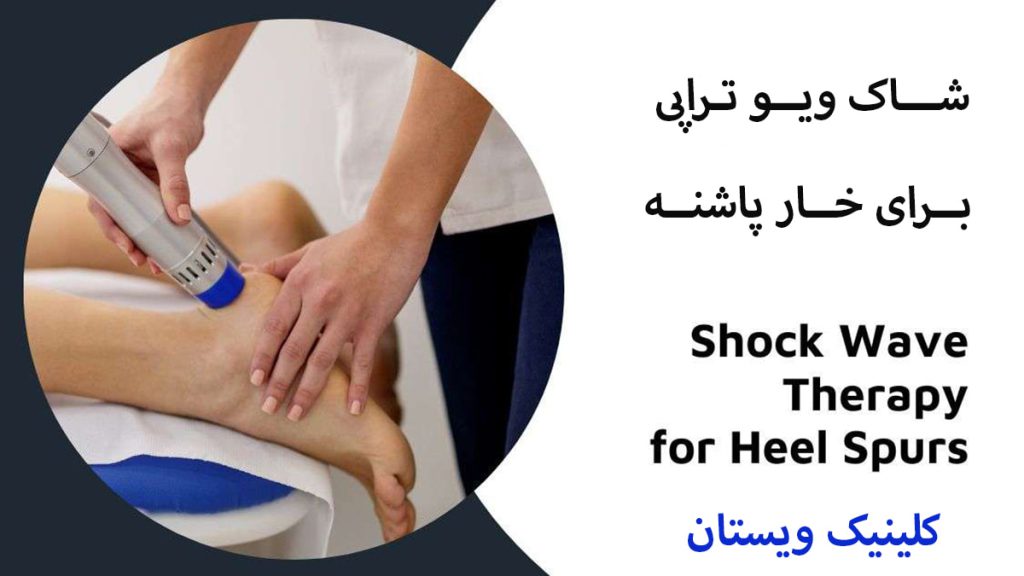درمان خار پاشنه شاک ویو تراپی برای خارپاشنه در حال انجام است